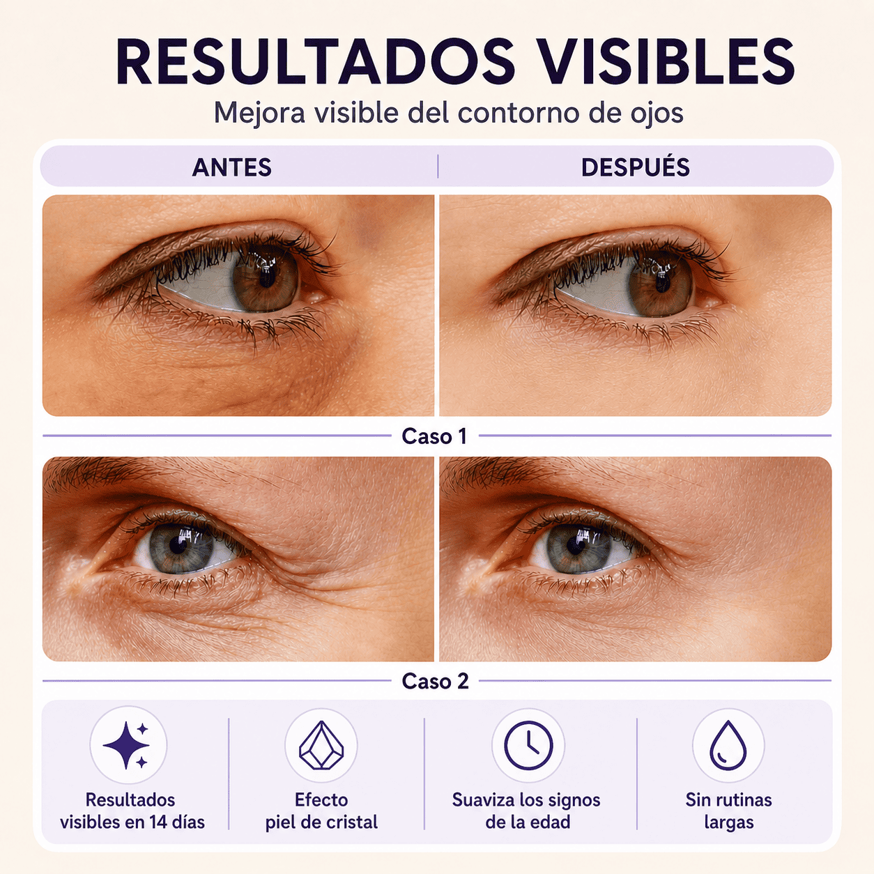 Efecto Lifting Inmediato: Rostro, Ojos y Cuello