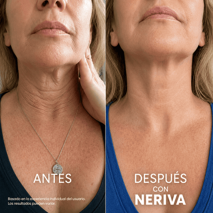 Reafirmante y Lifting Para el Cuello y Escote