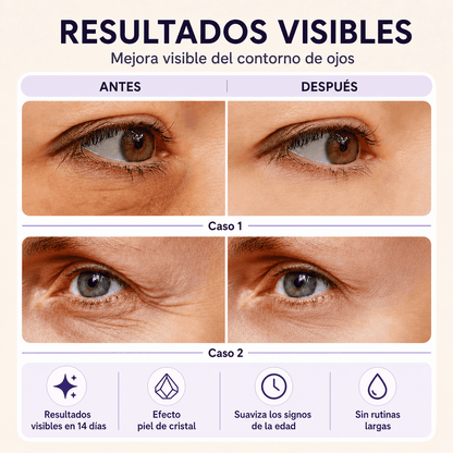 Efecto Lifting Inmediato: Rostro, Ojos y Cuello